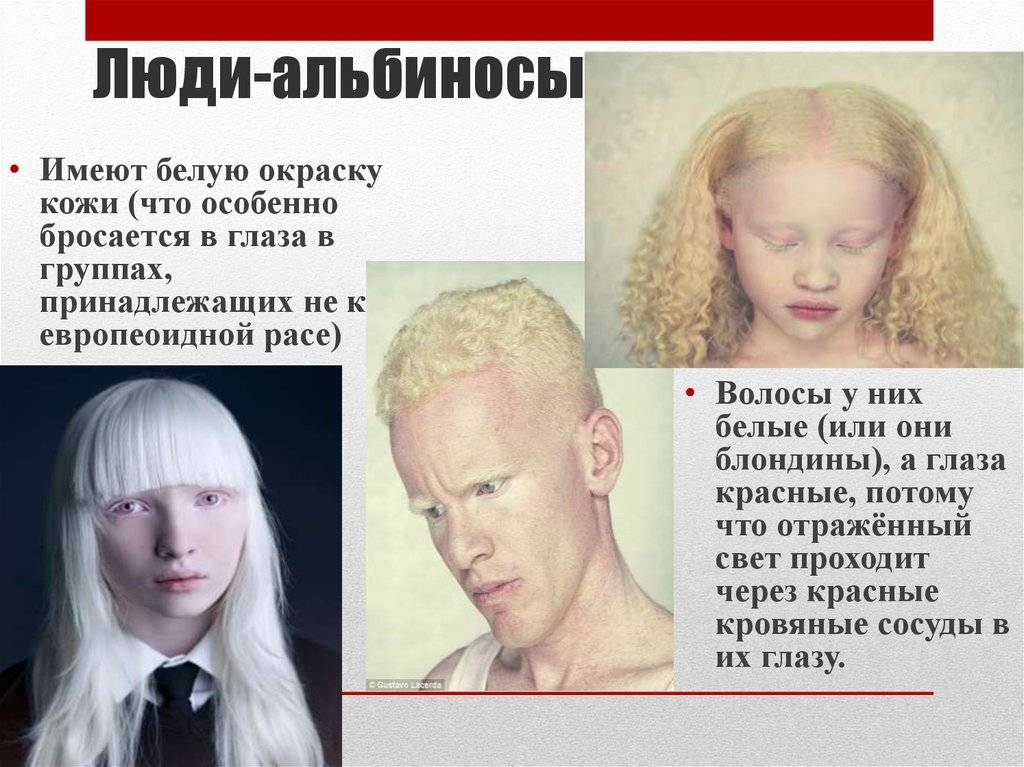 Моя собака альбинос? характеристика собак-альбиносов