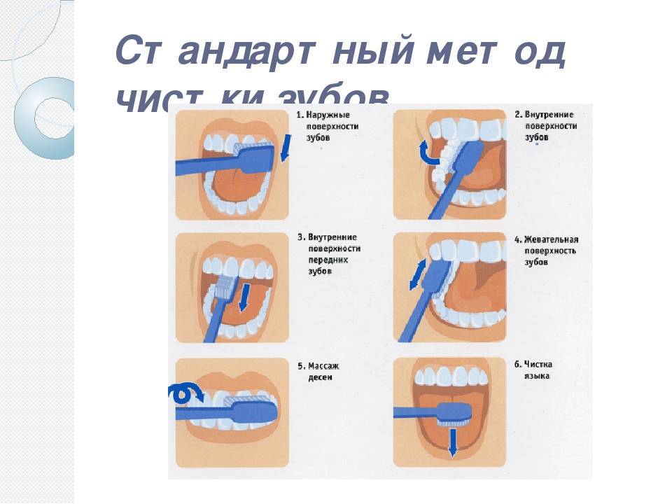 Электрические зубные щетки: польза и вред