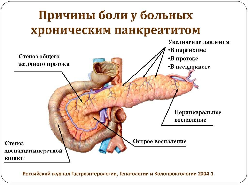 Расстройства поджелудочной