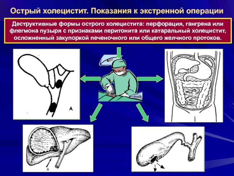 Ларингофарингеальный рефлюкс. - блог врача олега конобейцева
