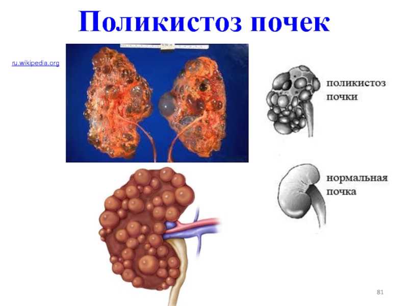 Поликистоз почек у кошек: лечение, симптомы, прогноз
