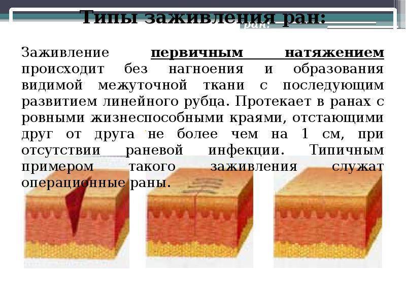 Можно ли кошке обработать рану зеленкой?